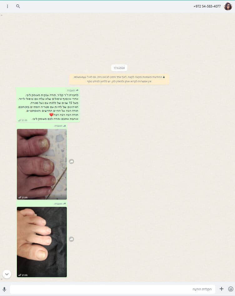 המלצה דוקטור קליר נוזל לפטרת ציפורניים