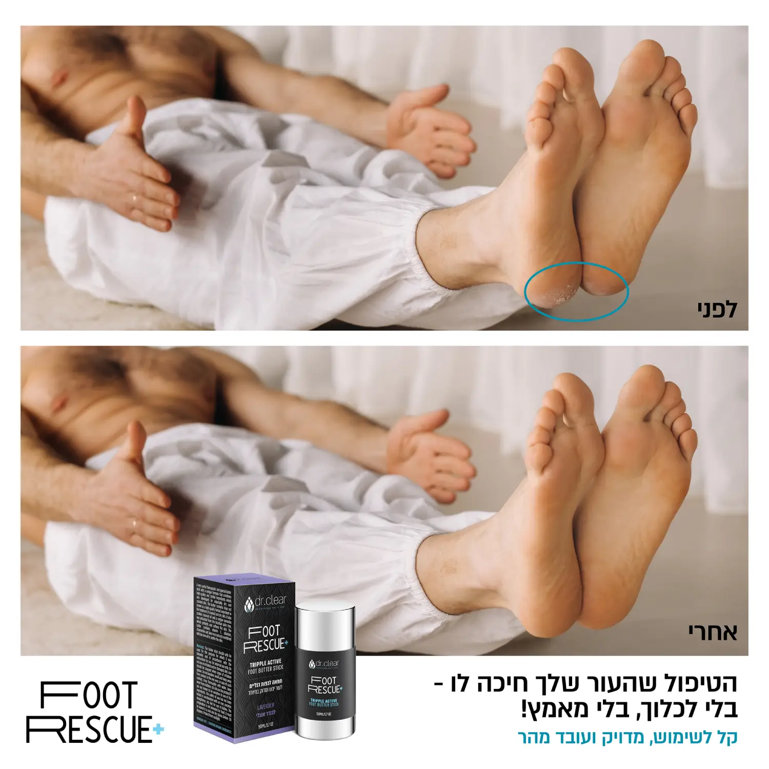 גבר שוכב על הגב ומציג תוצאות של לפני השימוש ואחרי השימוש בפוט רסקיו בעקבי הרגליים